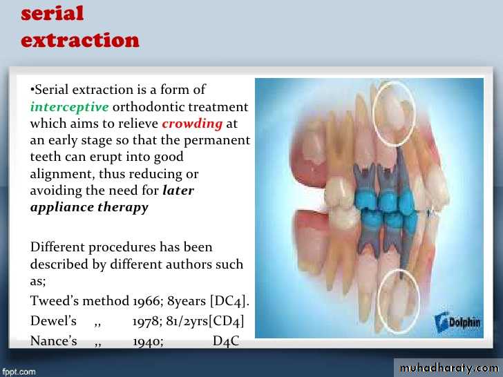 surgical aid to orthodonatic