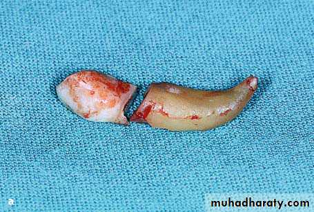surgical aid to orthodonatic