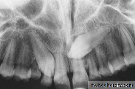 surgical aid to orthodonatic