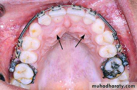 surgical aid to orthodonatic