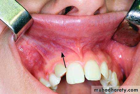 surgical aid to orthodonatic