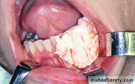 surgical aid to orthodonatic