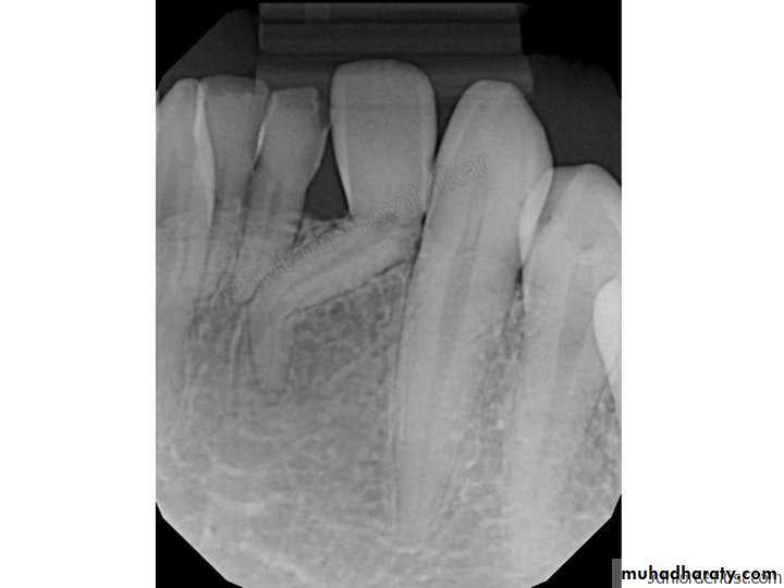 surgical aid to orthodonatic