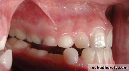 surgical aid to orthodonatic