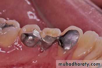 surgical aid to orthodonatic