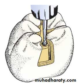 Tooth preparation