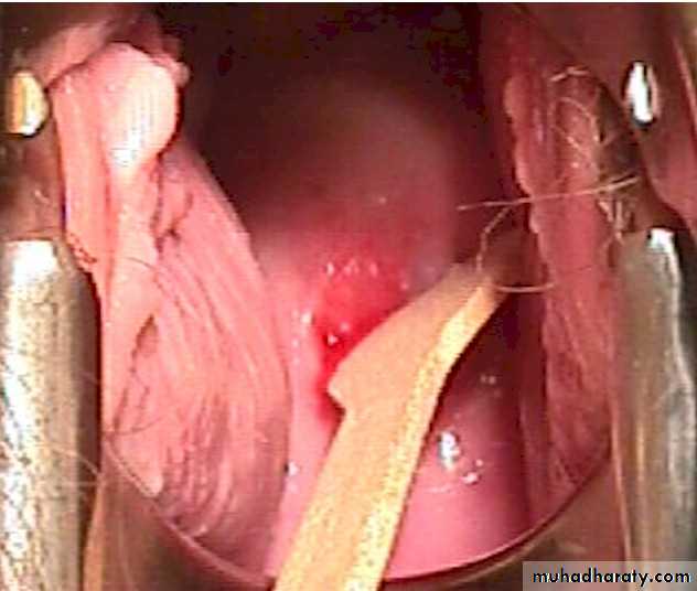Premalignat disease