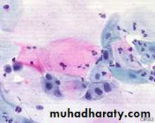 Premalignat disease