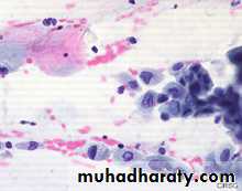 Premalignat disease