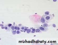 Premalignat disease