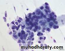 Premalignat disease