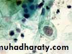 Premalignat disease