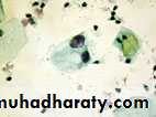 Premalignat disease