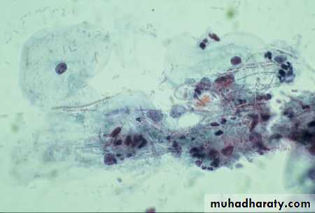 Premalignat disease
