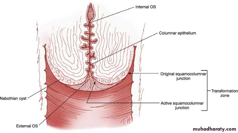 Premalignat disease