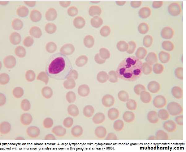 WBCdisorder