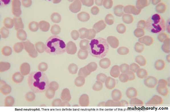 WBCdisorder