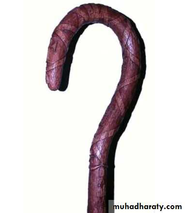 bone tumor2