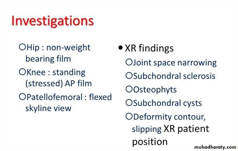 OSTEOARTHRITIS