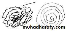 movement disorder
