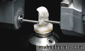 ImpressionTechnique