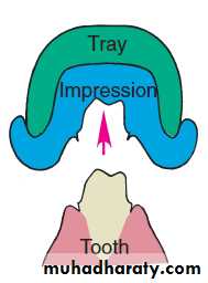 ImpressionTechnique