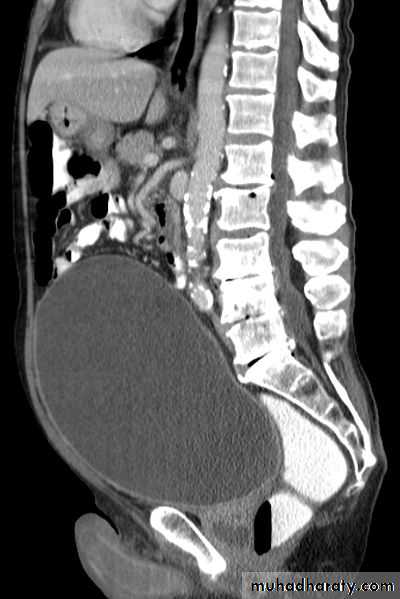 urology