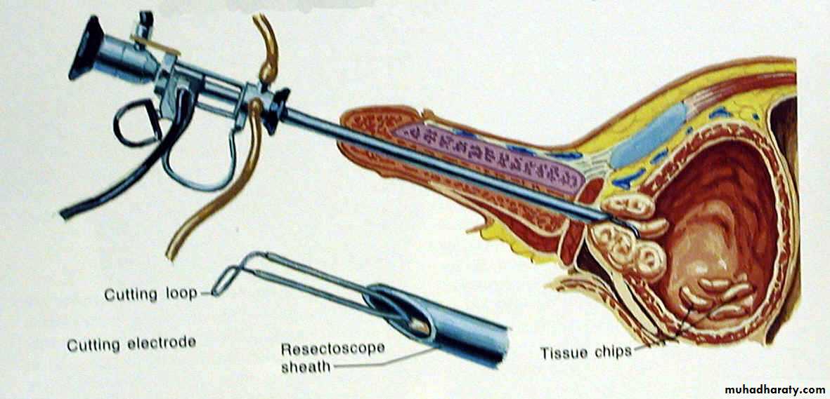 urology