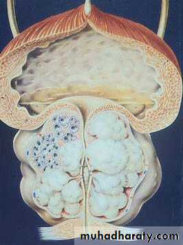 urology