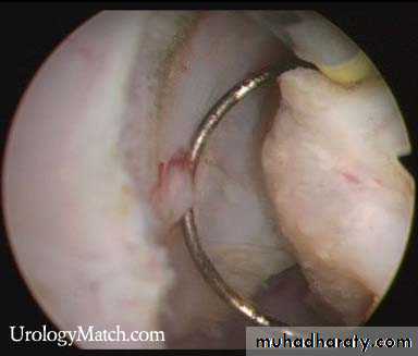 urology