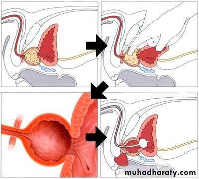 urology
