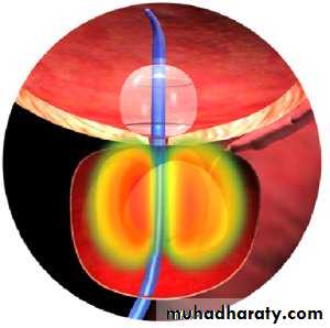 urology