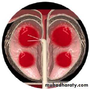 urology