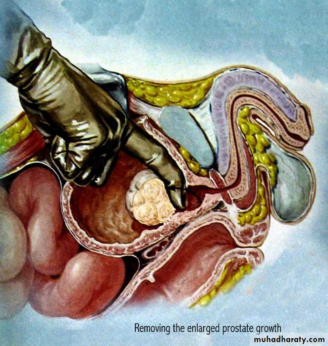 urology