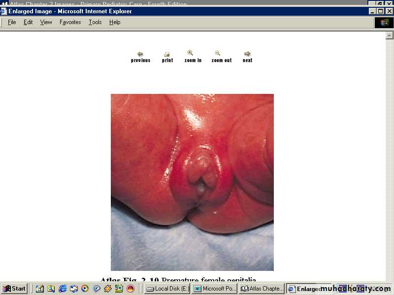 Neonatology