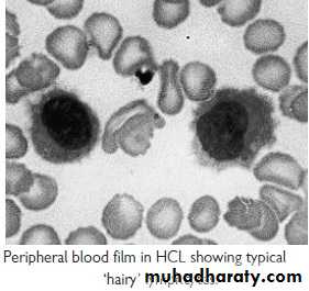 lymphomas