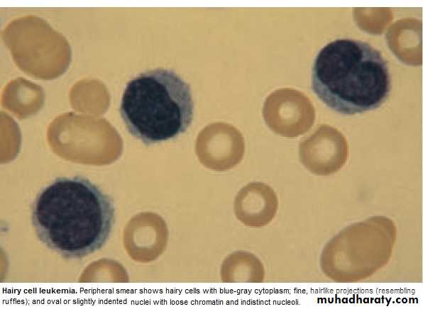 lymphomas