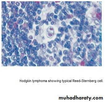 lymphomas