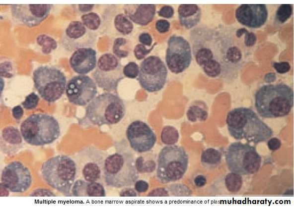 lymphomas