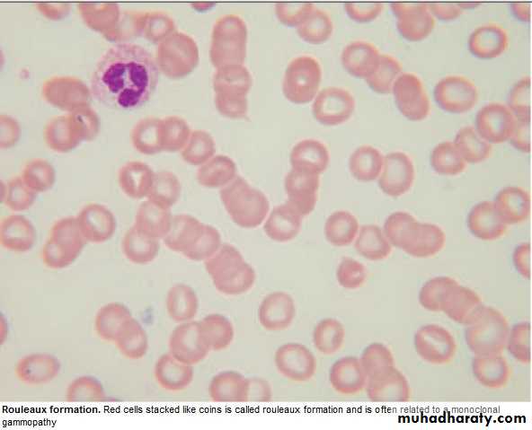lymphomas