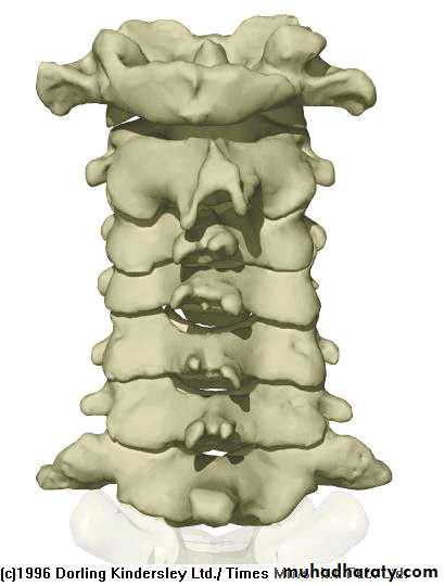 Injuries of the thoracic spine