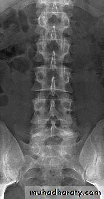Injuries of the thoracic spine