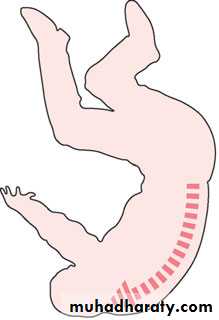 Injuries of the thoracic spine