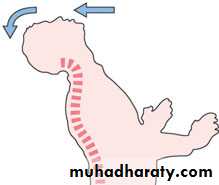 Injuries of the thoracic spine