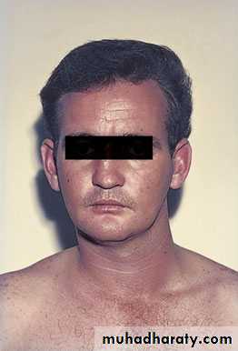 Injuries of the thoracic spine