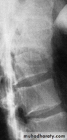 Injuries of the thoracic spine