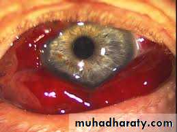 Pertusis and Varicella