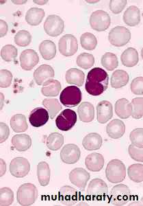 Pertusis and Varicella