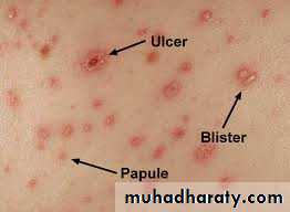 Pertusis and Varicella