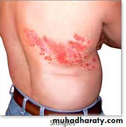 Pertusis and Varicella